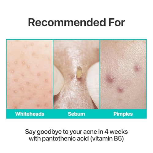 numbuzin No.1 Pantothenic B5 Active Soothing Cream 2.70 fl oz