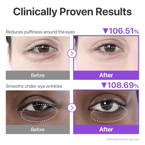 numbuzin No.9 NAD+ Collagen Eye Patches (10 Patches)