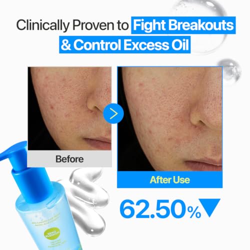 numbuzin Zero Blemish Oil-Free Micellar Cleansing Jelly 6.76 fl oz