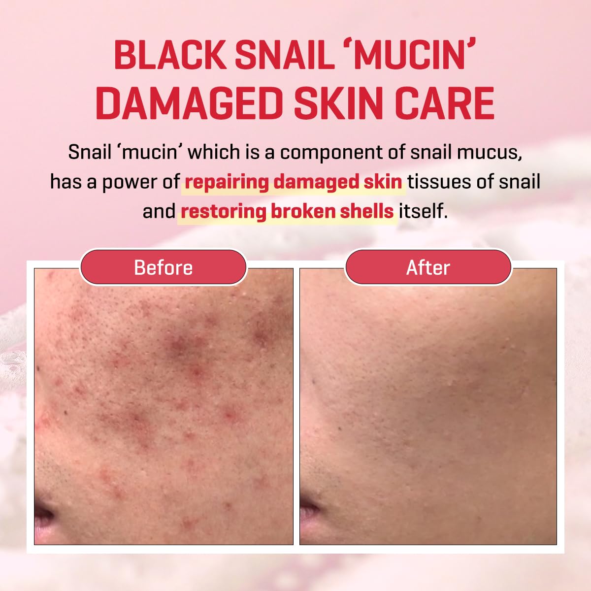 Snail Trucica Miracle Repair Serum 1.7oz