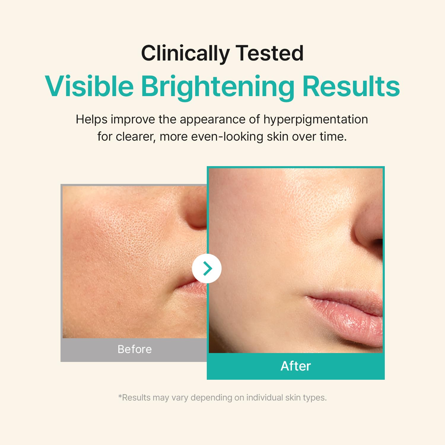 Licorice pH Balancing Advanced Facial Serum Ampoule | 8809129645596