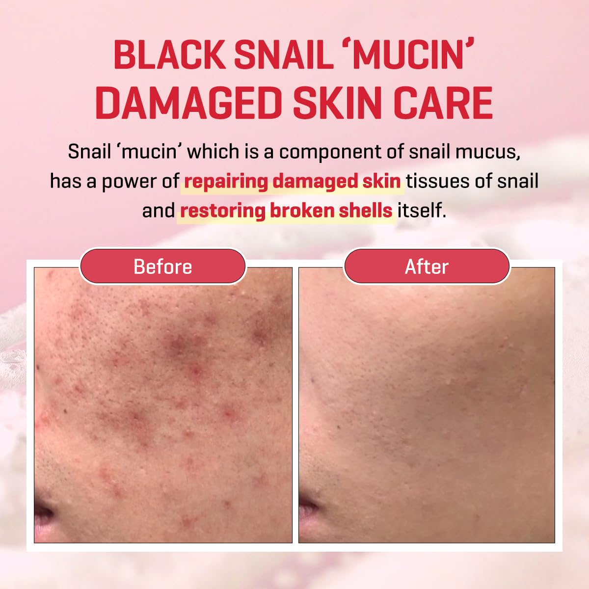 Snail Truecica Miracle Repair Low pH Gel Cleanser 3.38oz
