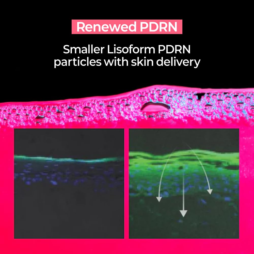 PDRN+ Lifting Face Mask 5-Pack
