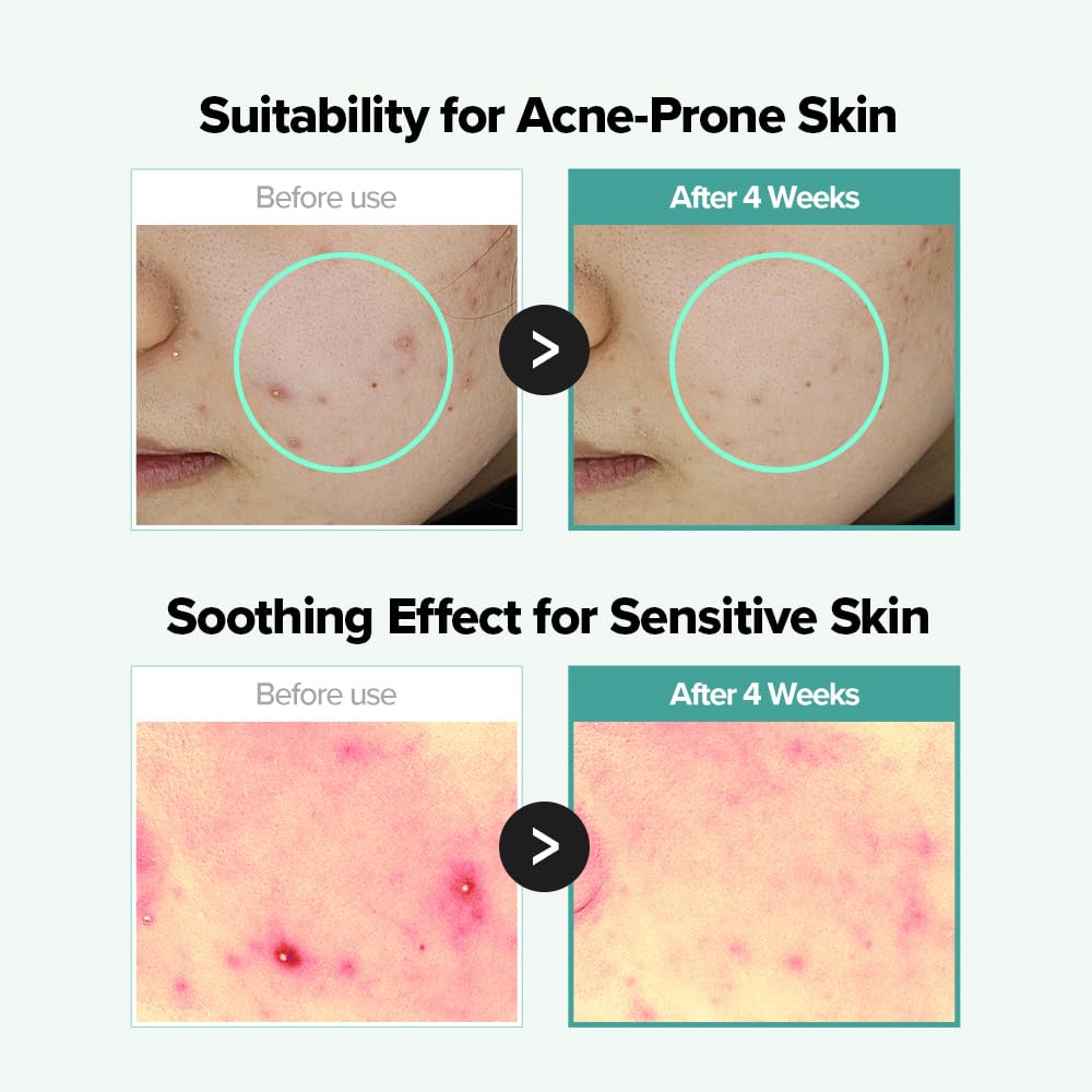 Lemongrass Niacinamide 20% Serum