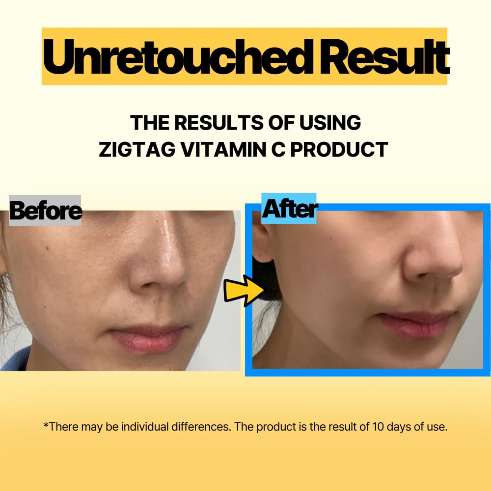 ZIGTAG Vitamin C 15% Super Blast Ampoule 24ml