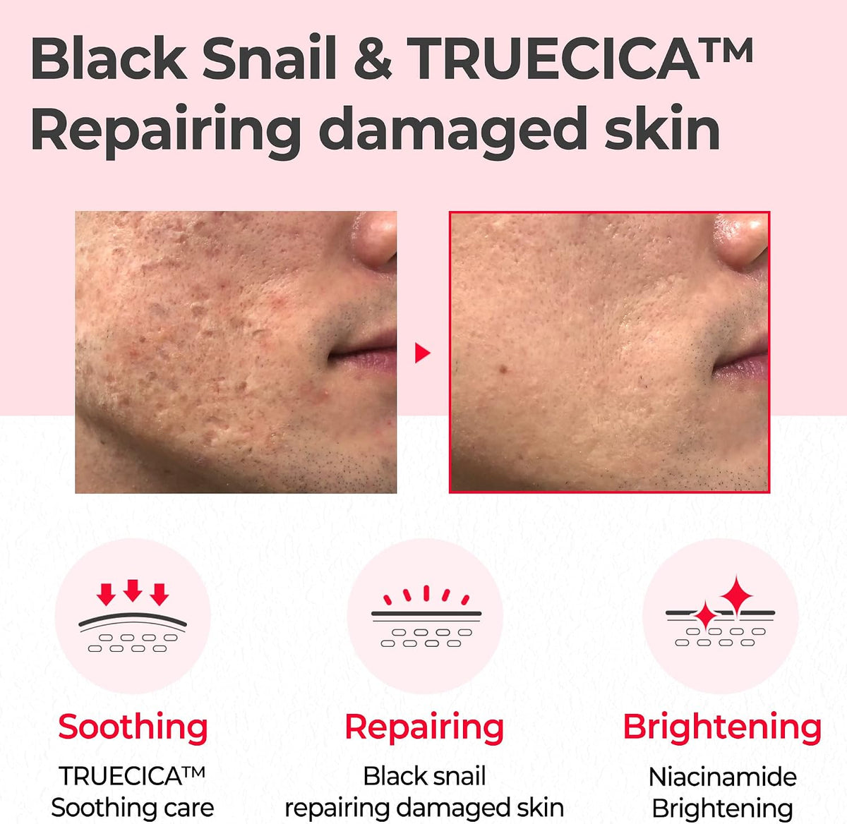Snail Truecica Miracle Repair Toner 4.6oz