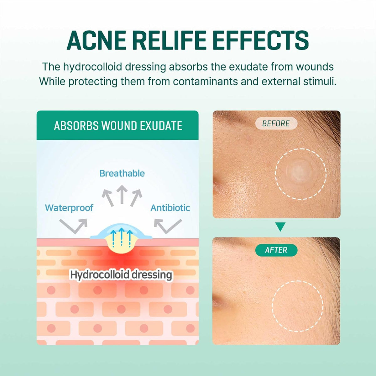 30 Days Miracle Clear Spot Patch