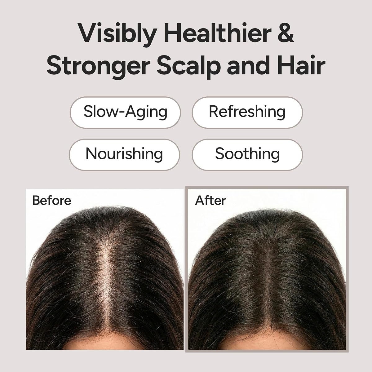 Scalp Serum Roll-On - Silica 3000 0.5 fl oz