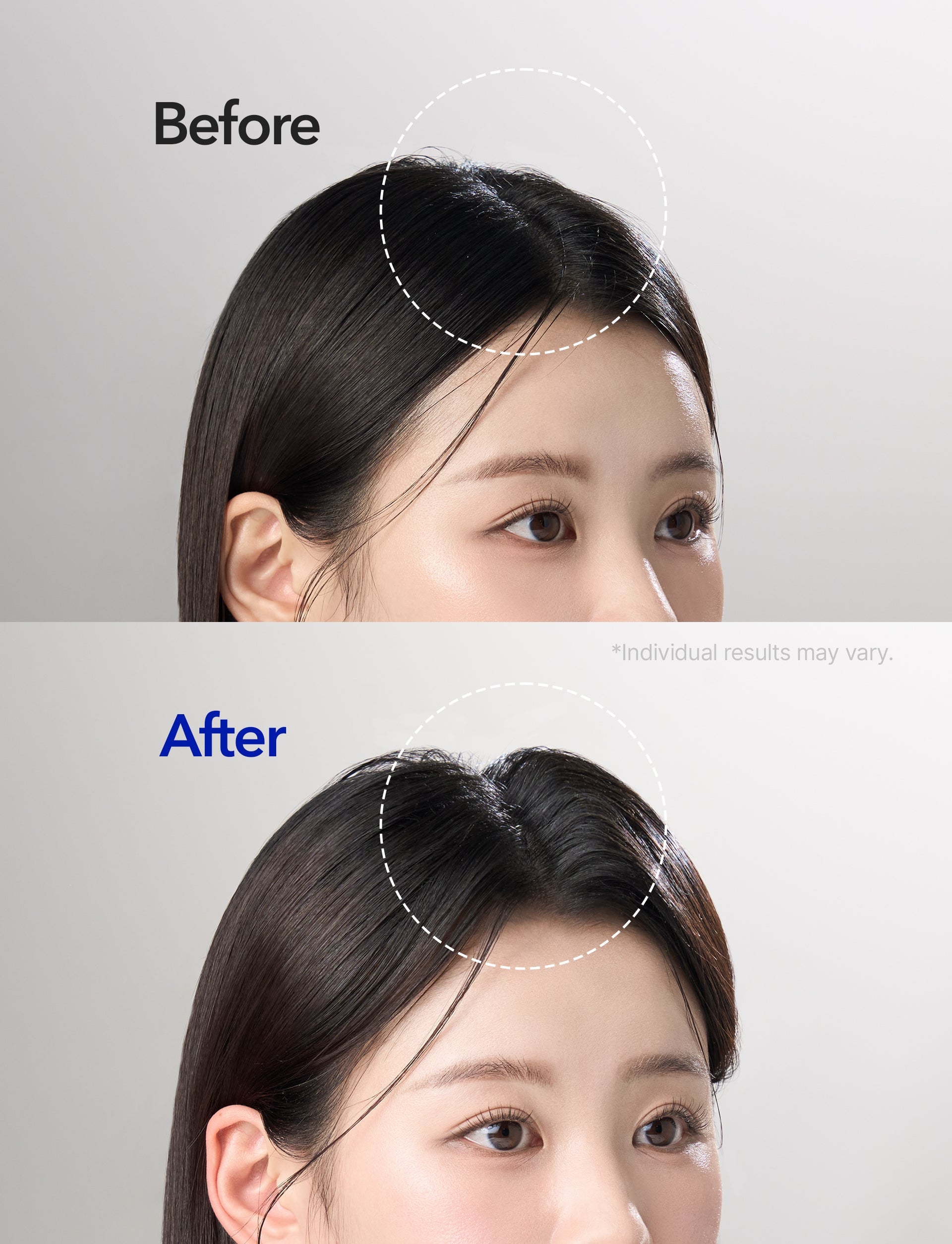 Spioxyl 400 Microneedling Hair Growth Serum 1oz