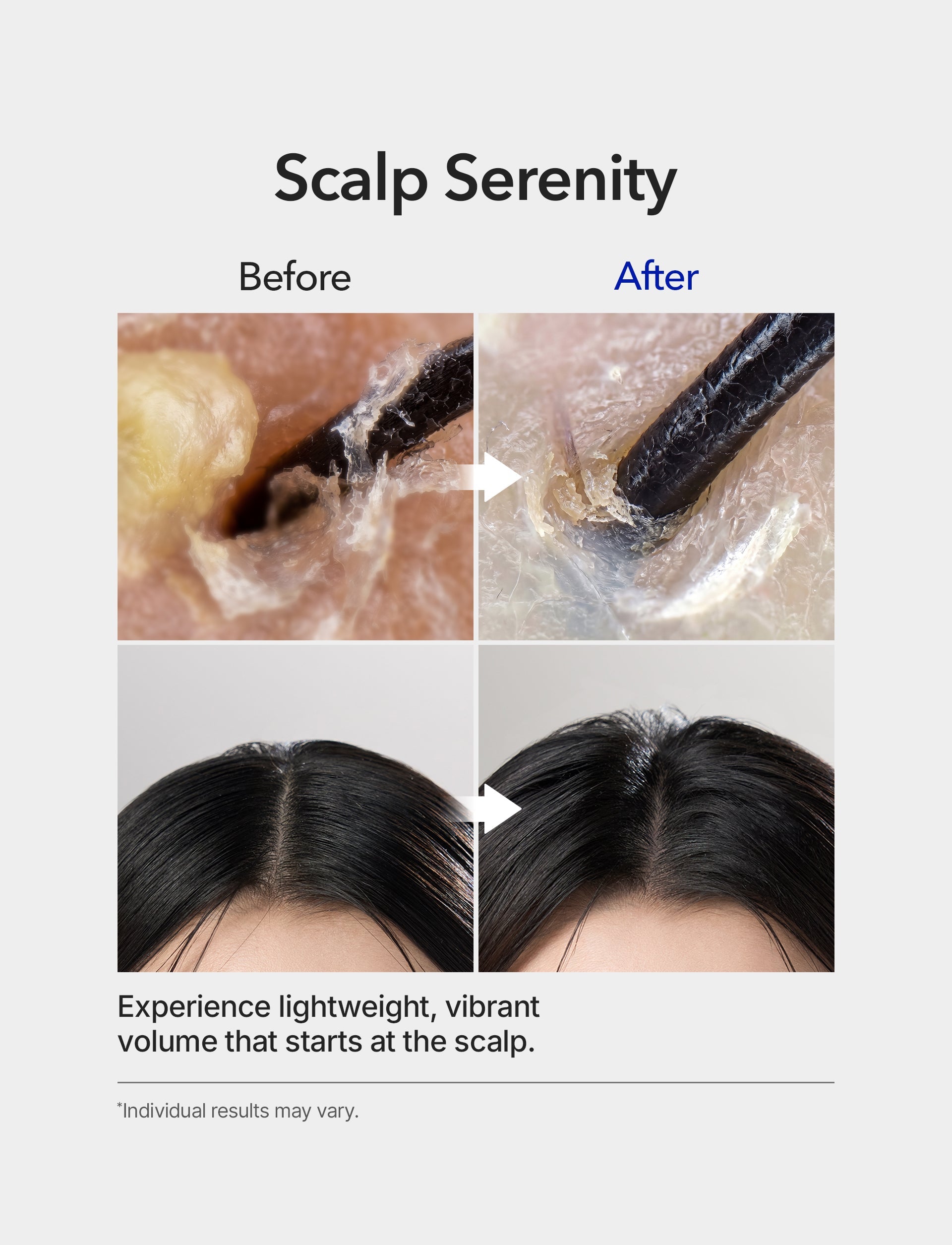 Spioxyl 400 Microneedling Hair Growth Serum 1oz