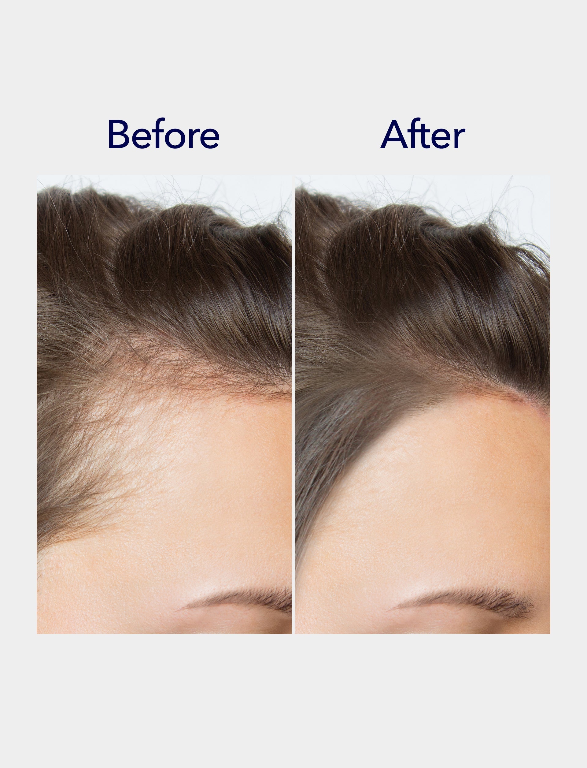 800 Microneedling Hair Growth Serum 1oz
