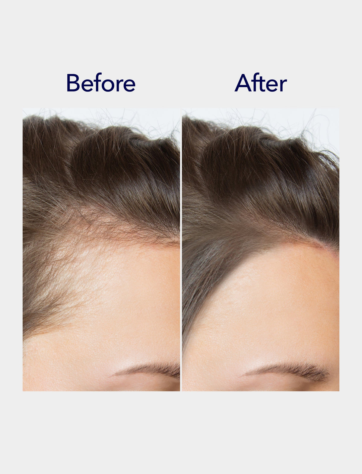 800 Microneedling Hair Growth Serum 1oz