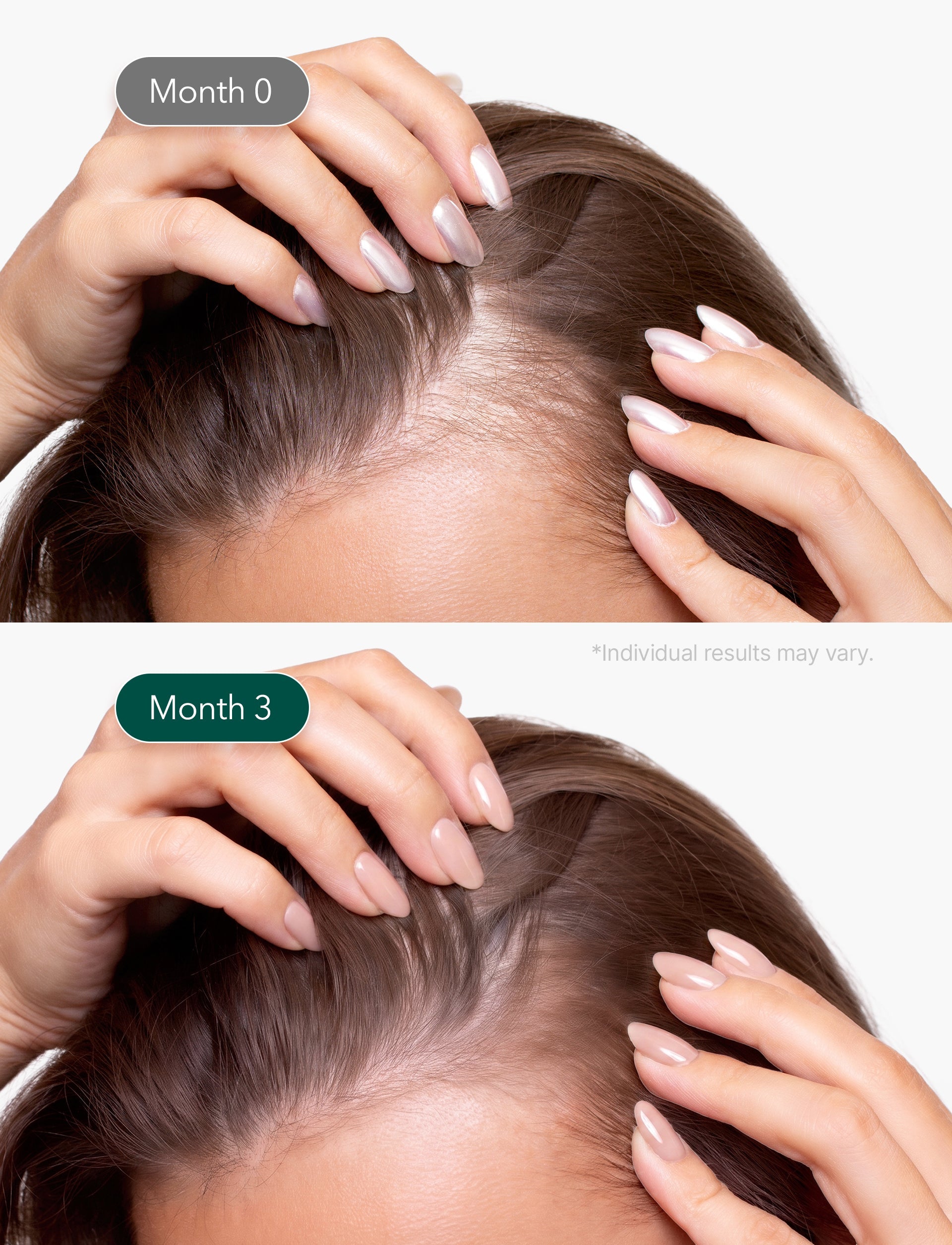 Micro Foam Scalp Treatment 1.7oz