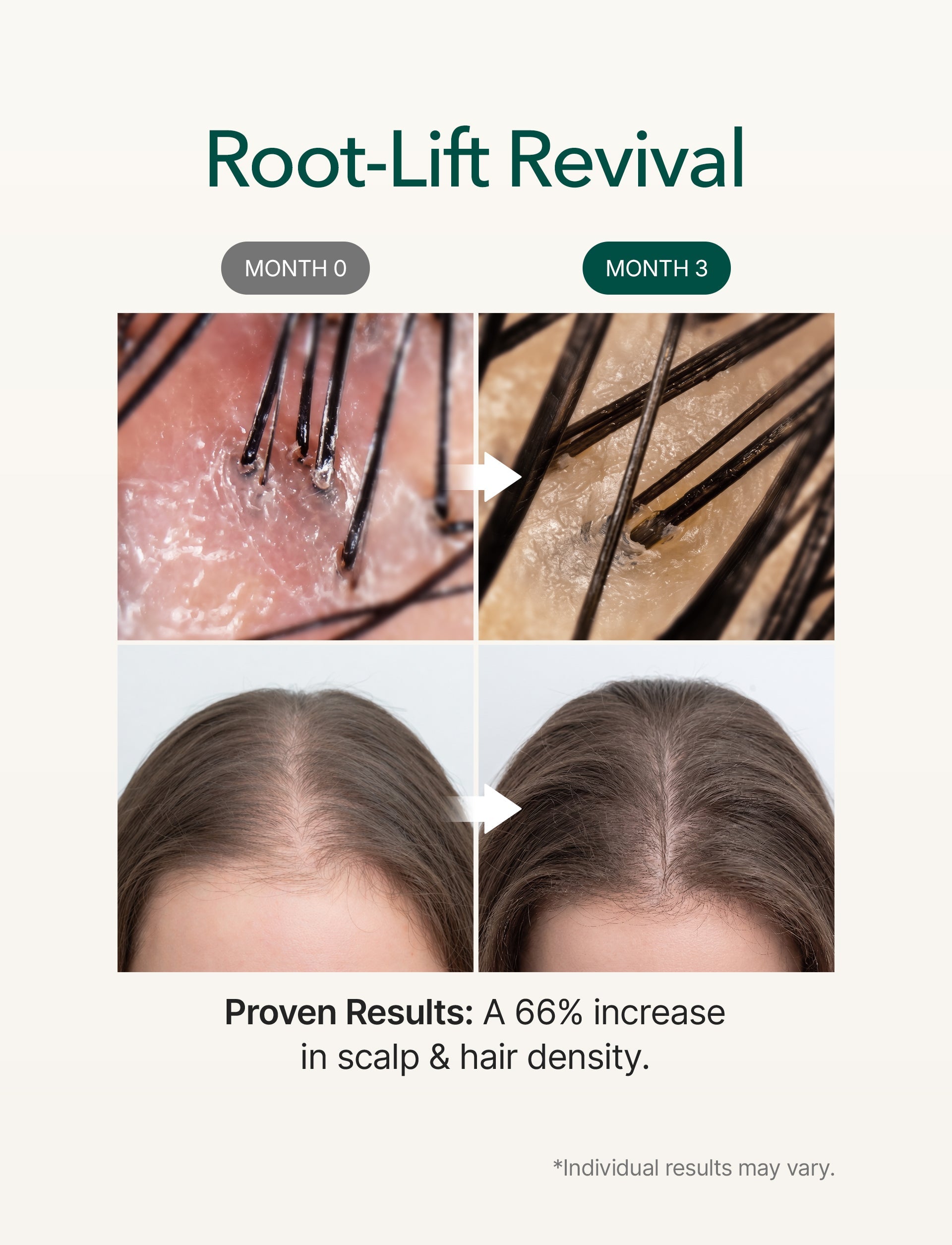Micro Foam Scalp Treatment 1.7oz